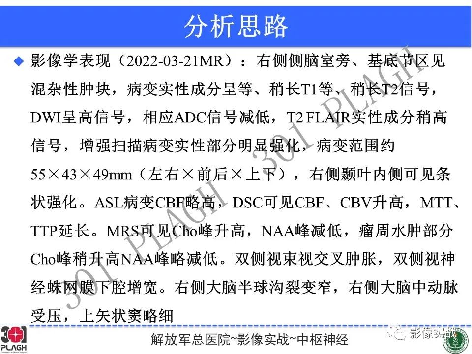 影像PPT - 【病例】中枢神经系统淋巴瘤1例CT及MR影像-21