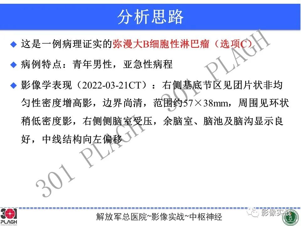 影像PPT - 【病例】中枢神经系统淋巴瘤1例CT及MR影像-20