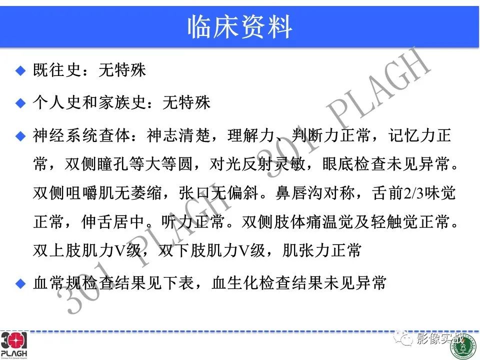 影像PPT - 【病例】中枢神经系统淋巴瘤1例CT及MR影像-3