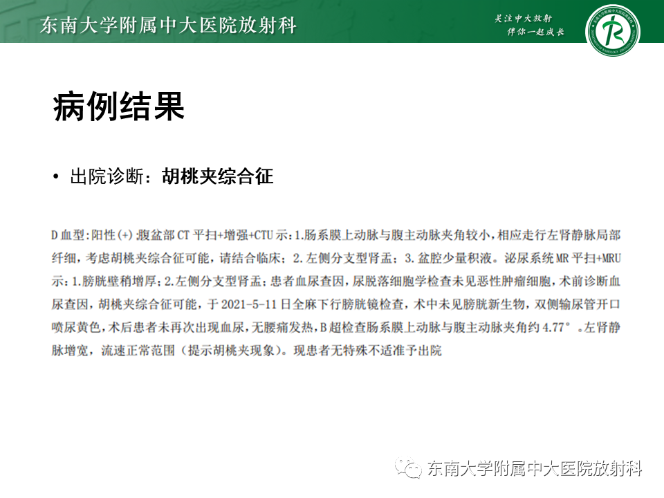 影像PPT - 【PPT】胡桃夹综合征-2