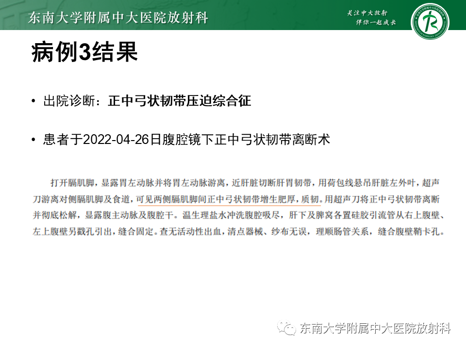 影像PPT - 【PPT】胡桃夹综合征-24