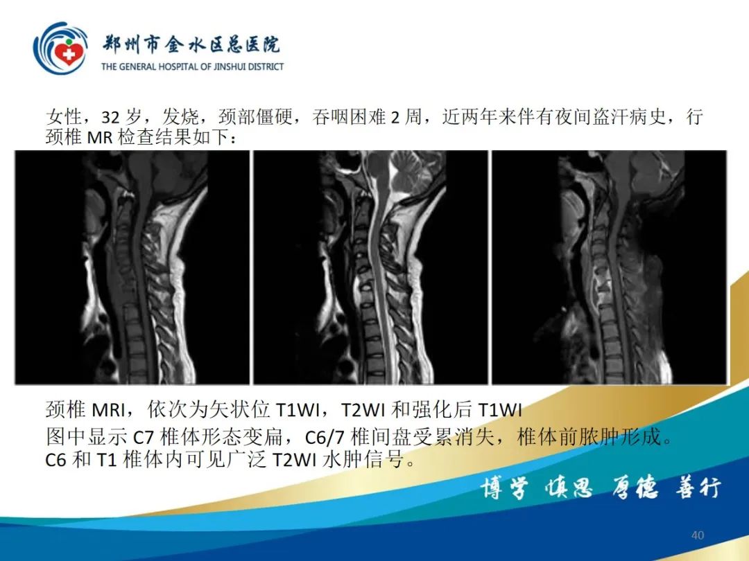 影像PPT - 【PPT】布鲁氏杆菌脊柱炎-40
