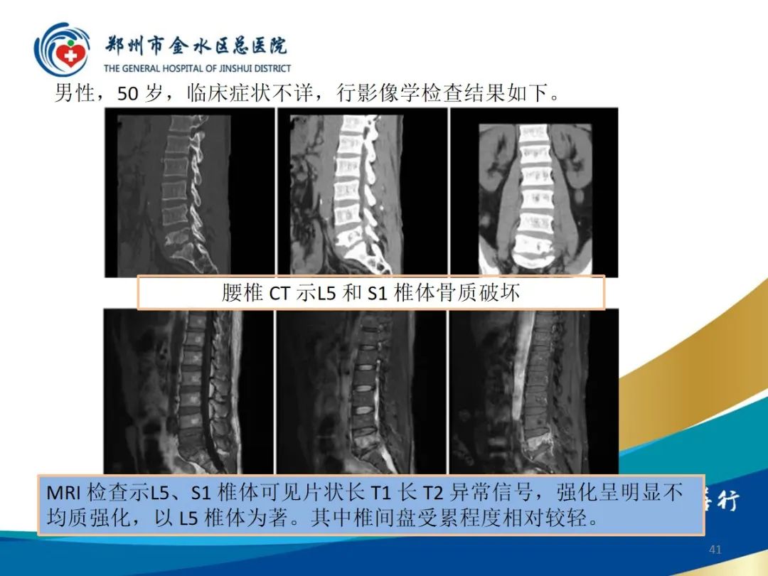 影像PPT - 【PPT】布鲁氏杆菌脊柱炎-41