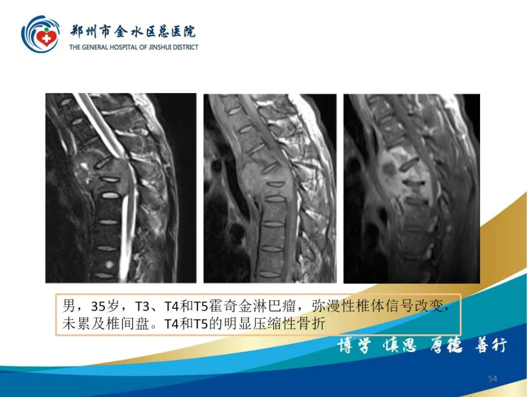 影像PPT - 【PPT】布鲁氏杆菌脊柱炎-54