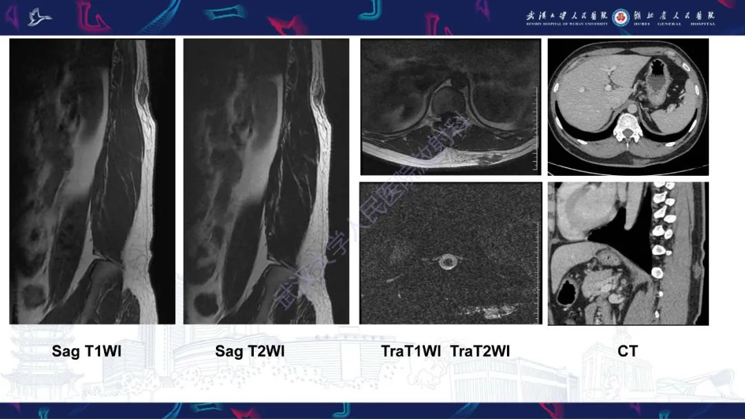 影像PPT - 【PPT】皮肤肿瘤影像诊断-3