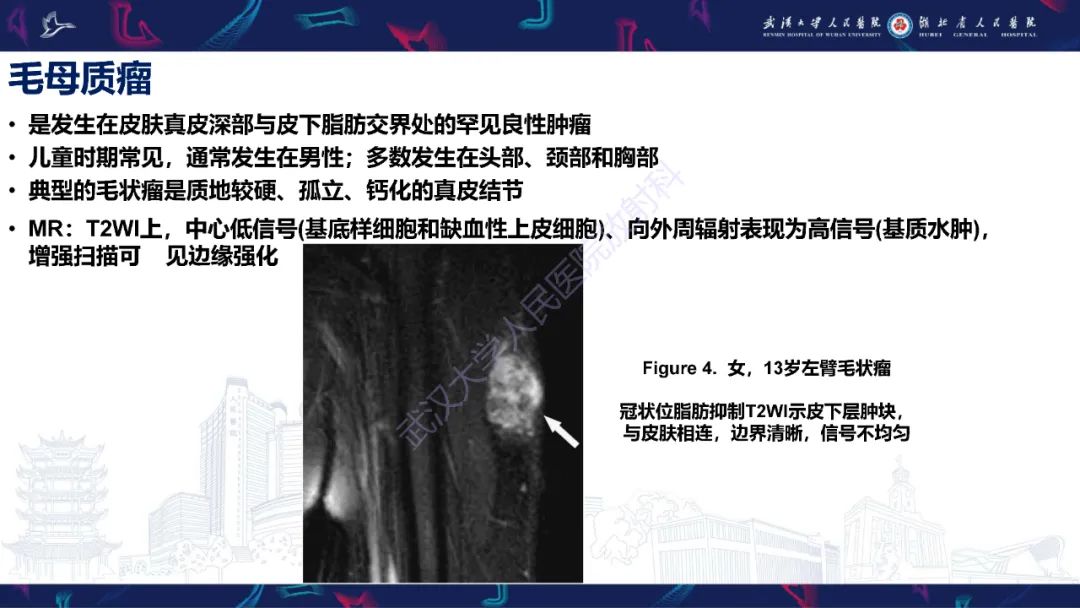 影像PPT - 【PPT】皮肤肿瘤影像诊断-14