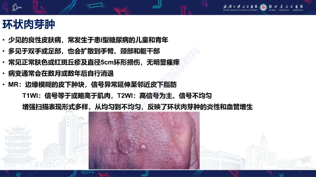 影像PPT - 【PPT】皮肤肿瘤影像诊断-17