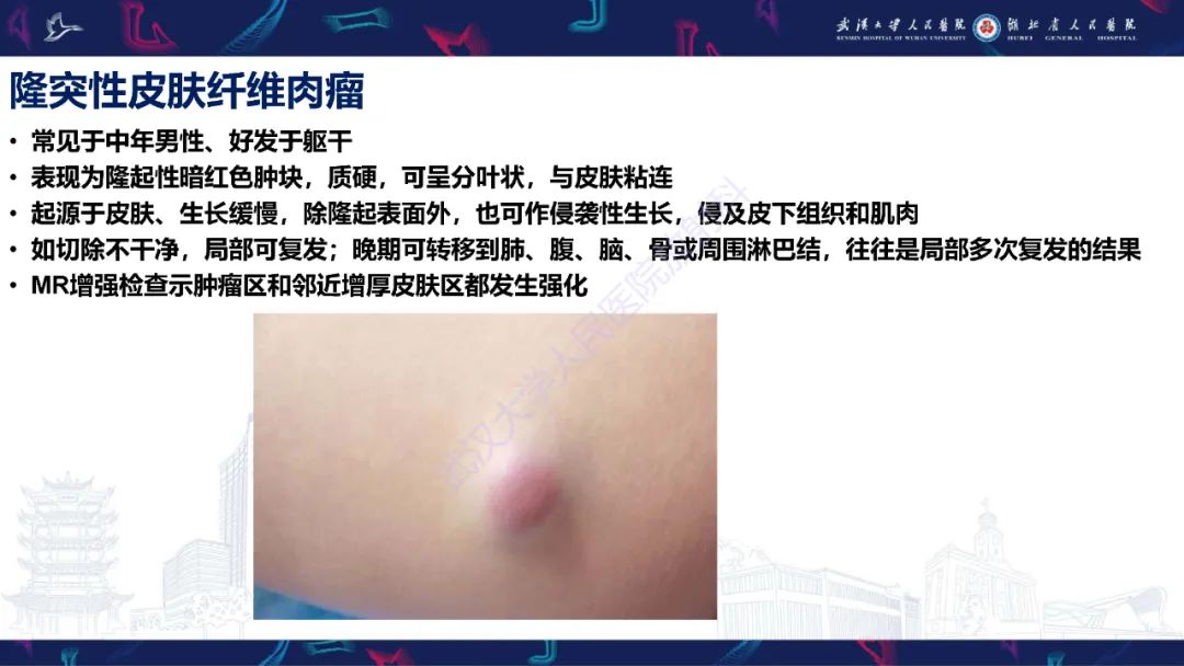 影像PPT - 【PPT】皮肤肿瘤影像诊断-19