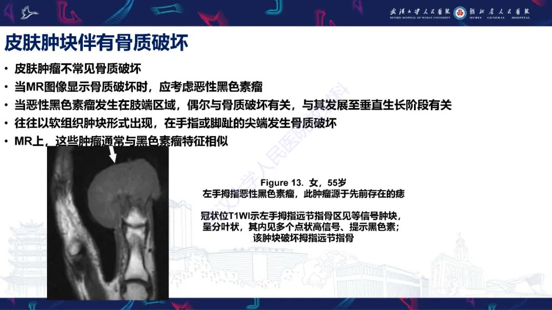 影像PPT - 【PPT】皮肤肿瘤影像诊断-28