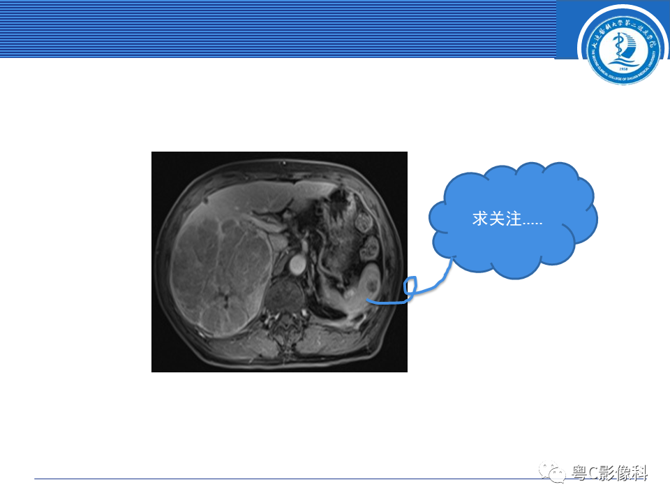 影像PPT - 【PPT】脾脏病变MRI表现-3
