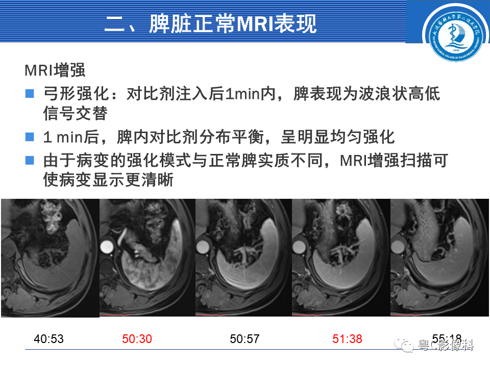 影像PPT - 【PPT】脾脏病变MRI表现-8