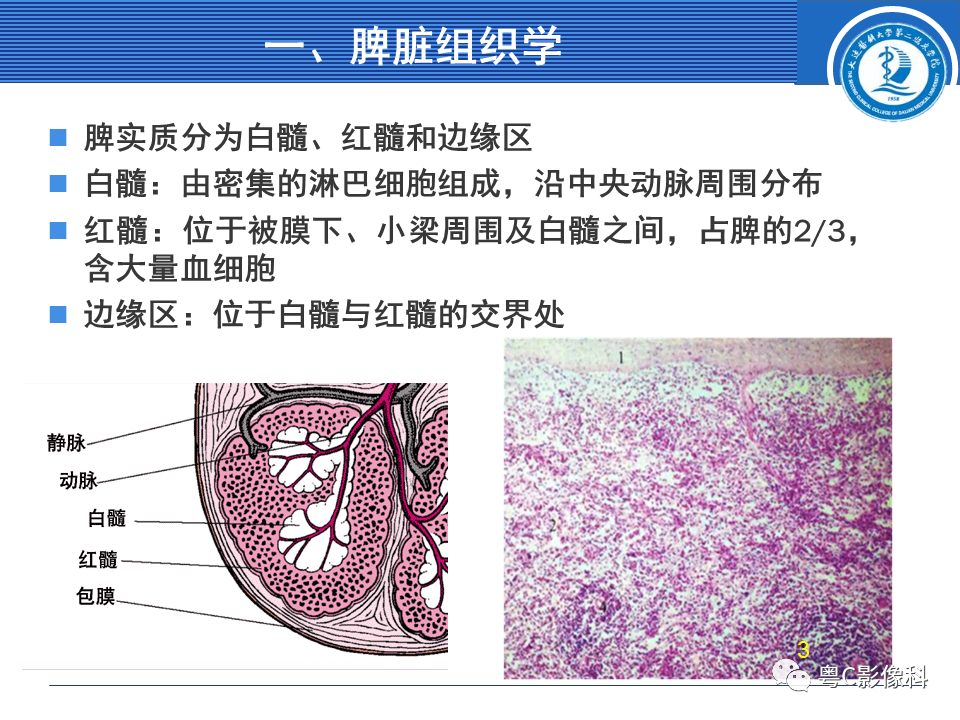 影像PPT - 【PPT】脾脏病变MRI表现-6