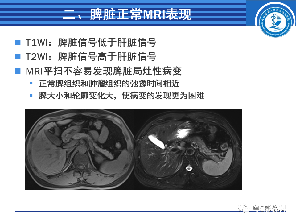 影像PPT - 【PPT】脾脏病变MRI表现-7