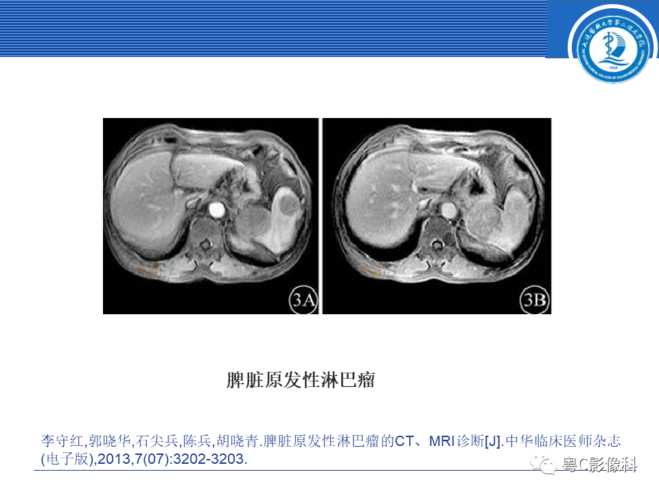影像PPT - 【PPT】脾脏病变MRI表现-33
