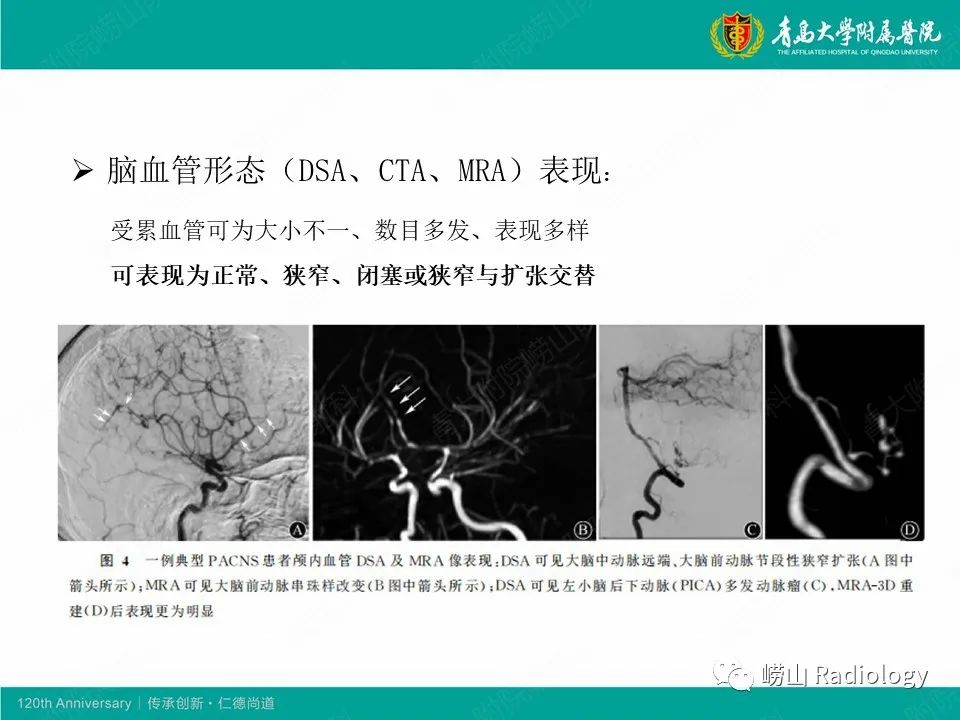 影像PPT - 【病例】中枢神经系统血管炎1例MR影像-29