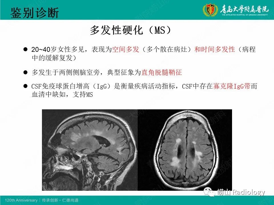 影像PPT - 【病例】中枢神经系统血管炎1例MR影像-31