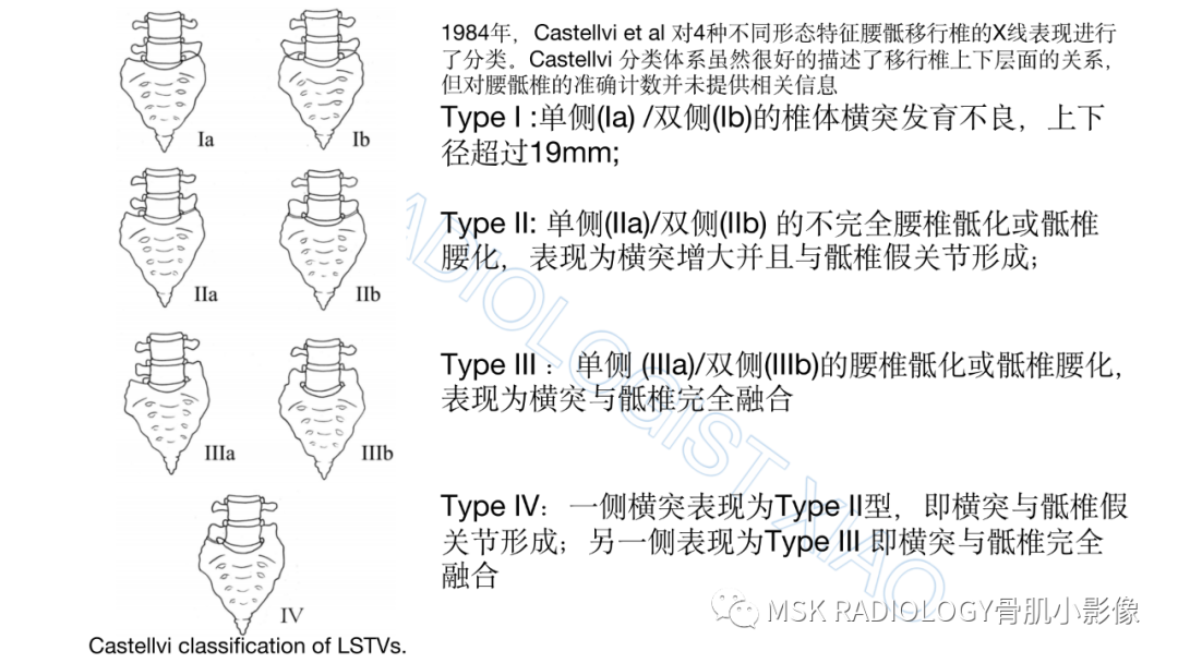 影像PPT - 【PPT】腰骶移行椎-2