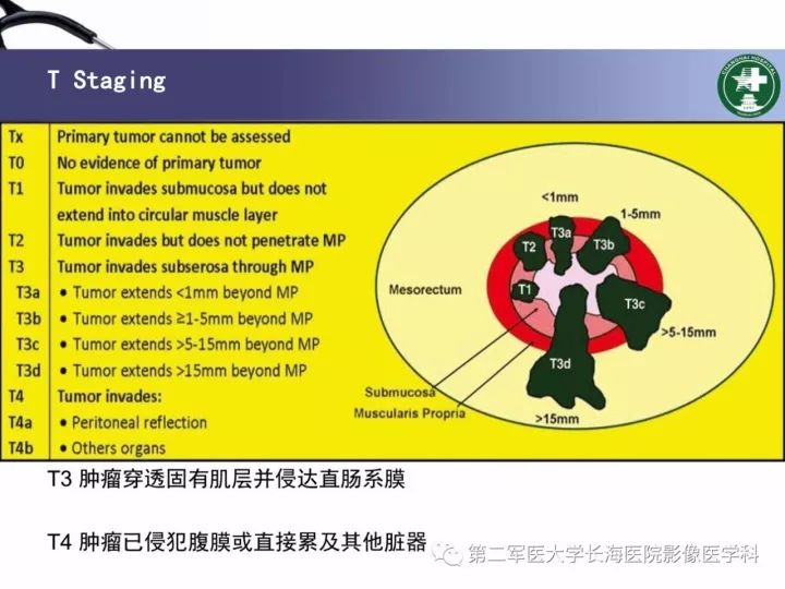 影像PPT - 【PPT】直肠癌MRI-11