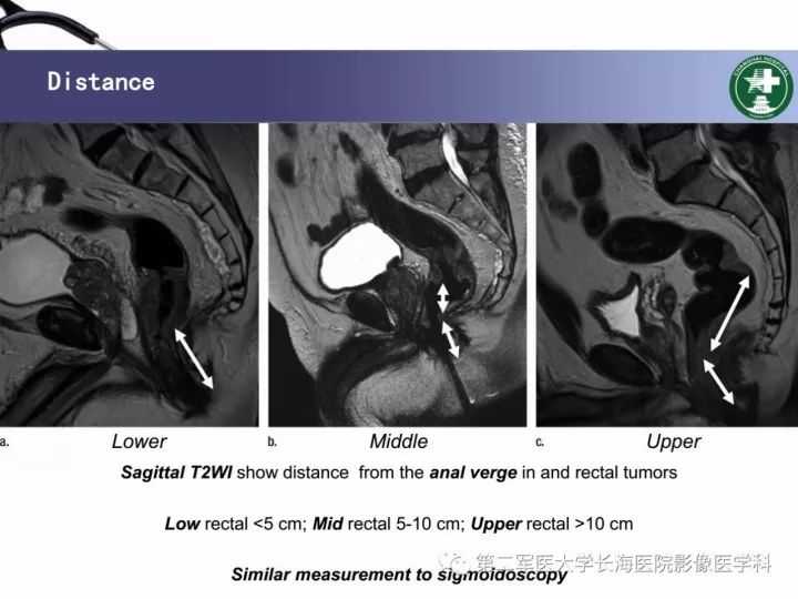 影像PPT - 【PPT】直肠癌MRI-8