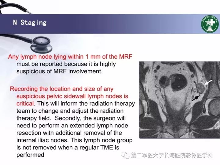 影像PPT - 【PPT】直肠癌MRI-22