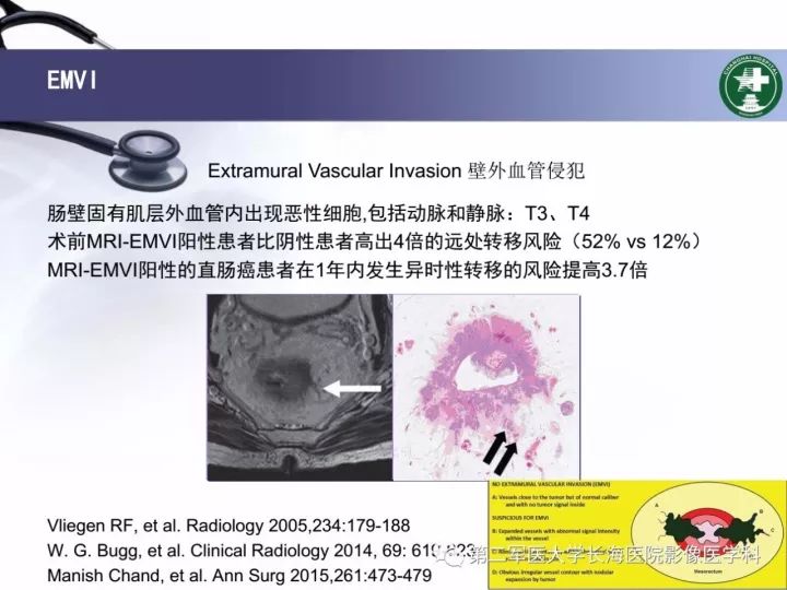 影像PPT - 【PPT】直肠癌MRI-27