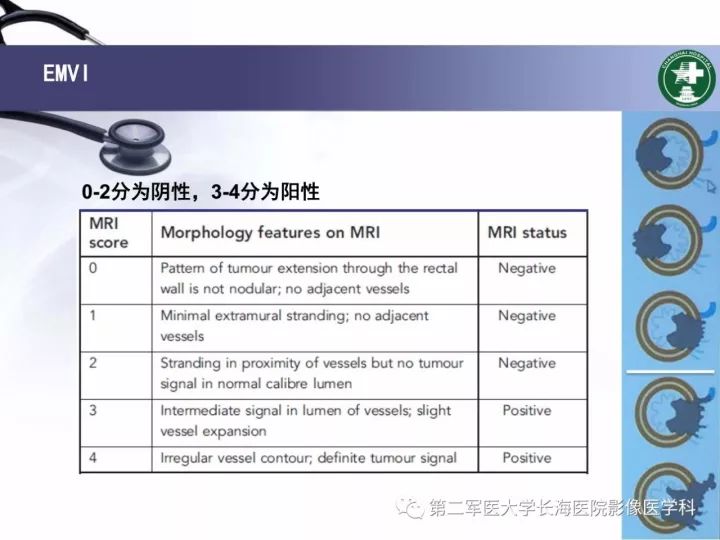 影像PPT - 【PPT】直肠癌MRI-28