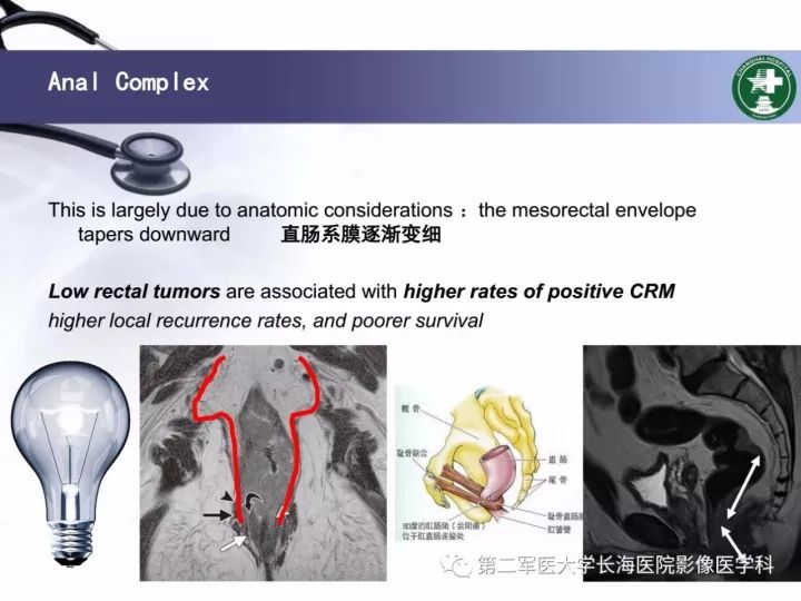 影像PPT - 【PPT】直肠癌MRI-16