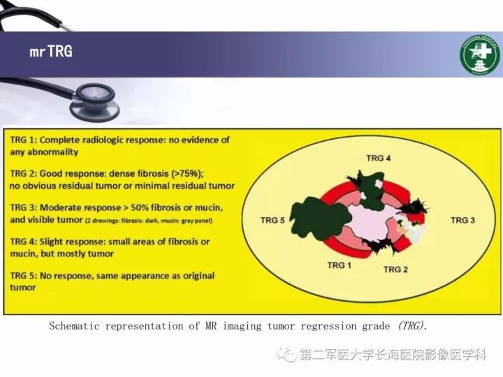 影像PPT - 【PPT】直肠癌MRI-38