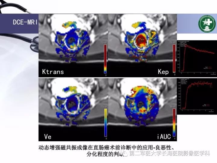 影像PPT - 【PPT】直肠癌MRI-45