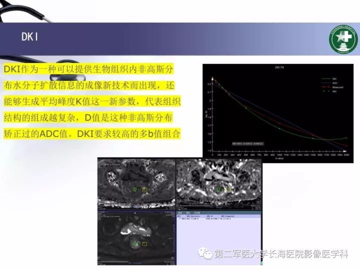 影像PPT - 【PPT】直肠癌MRI-48