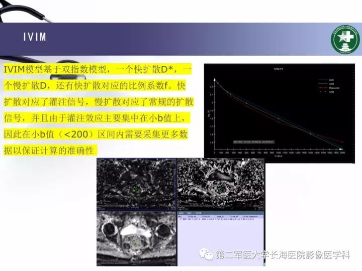 影像PPT - 【PPT】直肠癌MRI-47