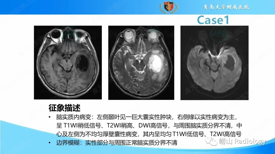 影像PPT - 【PPT】颅内肿瘤性病变-13