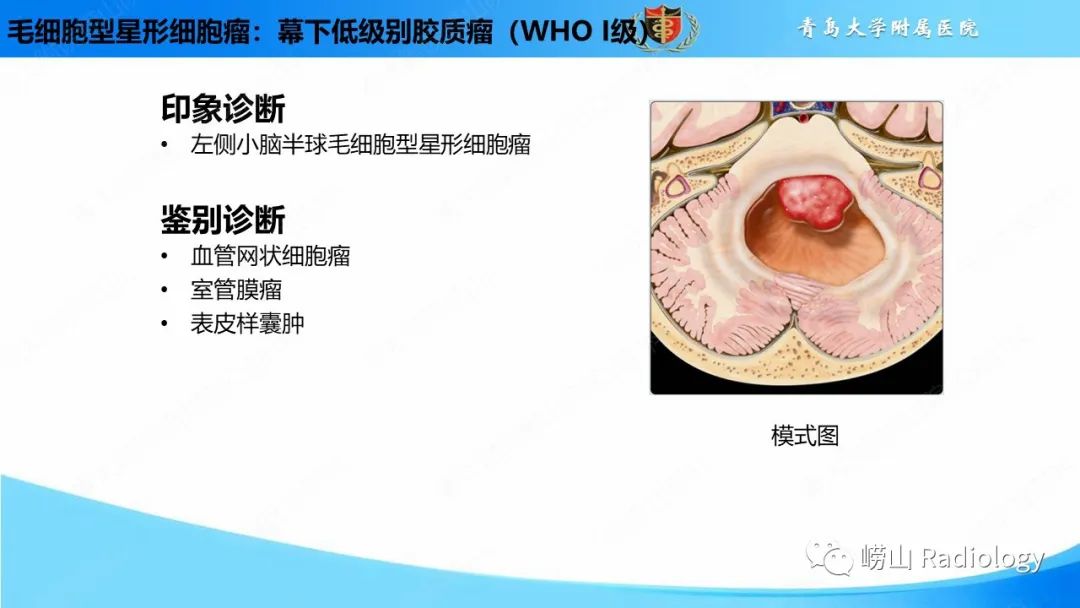 影像PPT - 【PPT】颅内肿瘤性病变-22