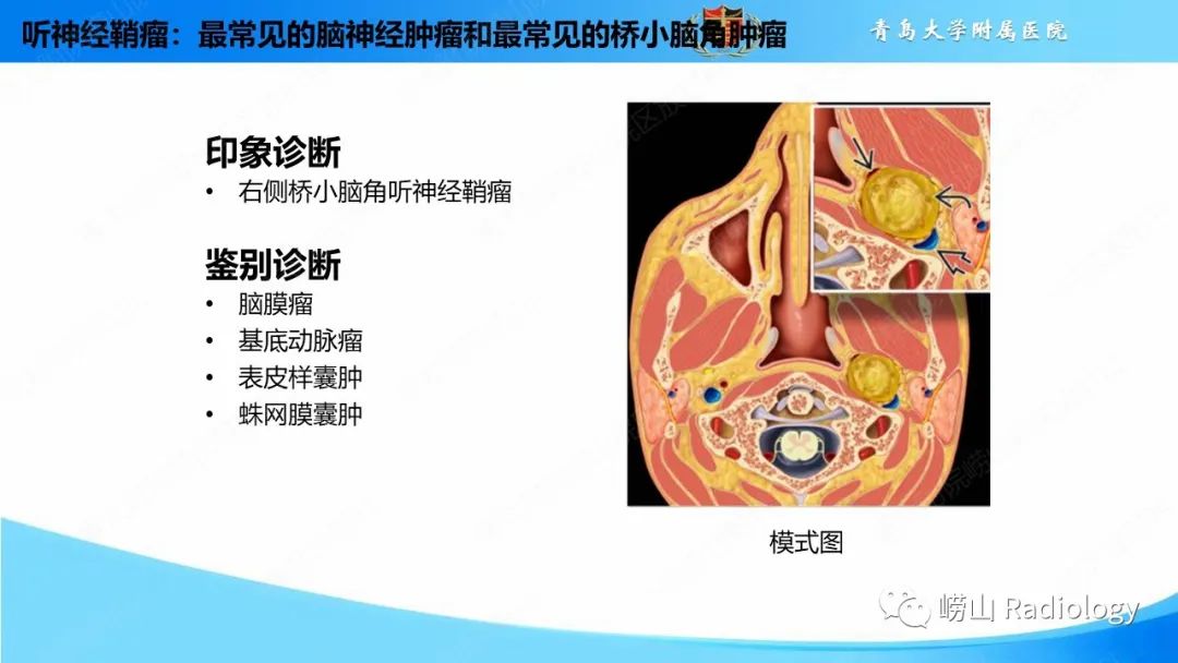 影像PPT - 【PPT】颅内肿瘤性病变-32