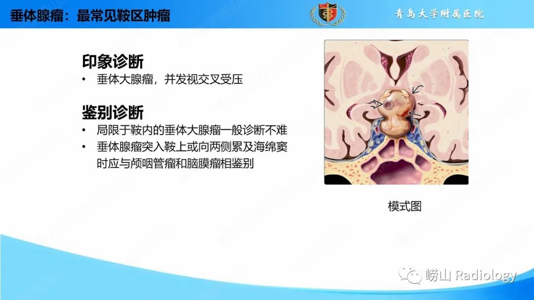 影像PPT - 【PPT】颅内肿瘤性病变-37