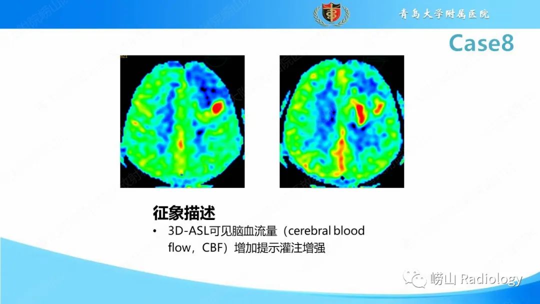 影像PPT - 【PPT】颅内肿瘤性病变-54