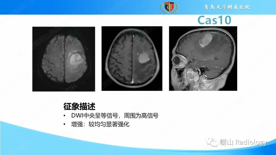 影像PPT - 【PPT】颅内肿瘤性病变-63