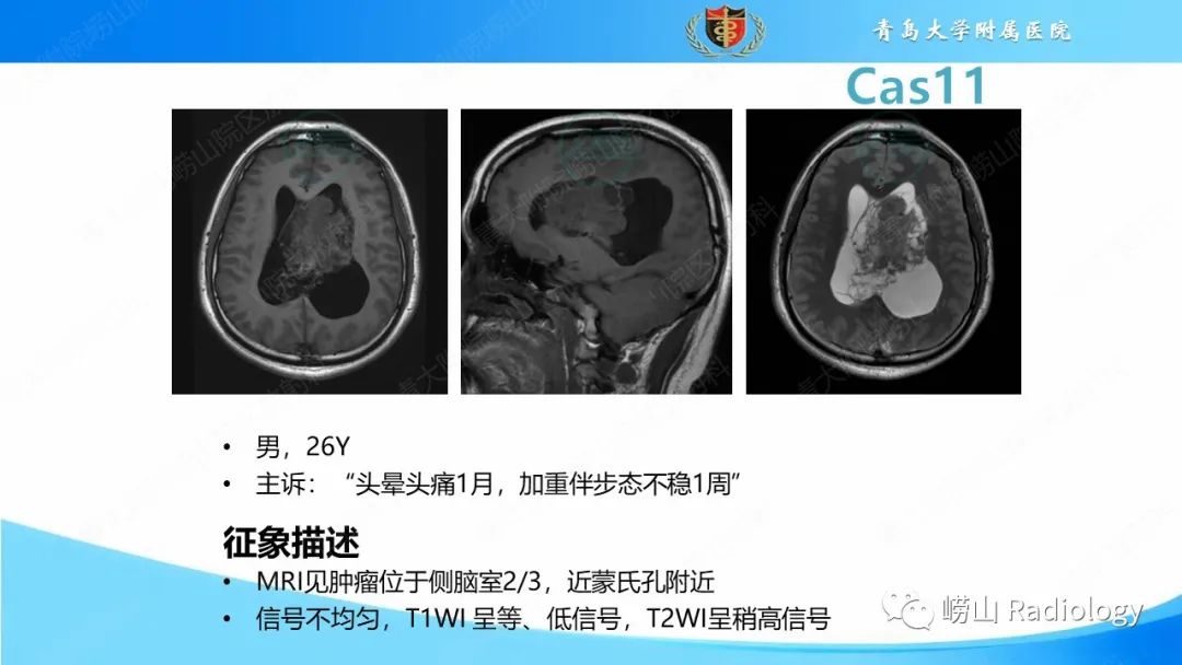 影像PPT - 【PPT】颅内肿瘤性病变-66