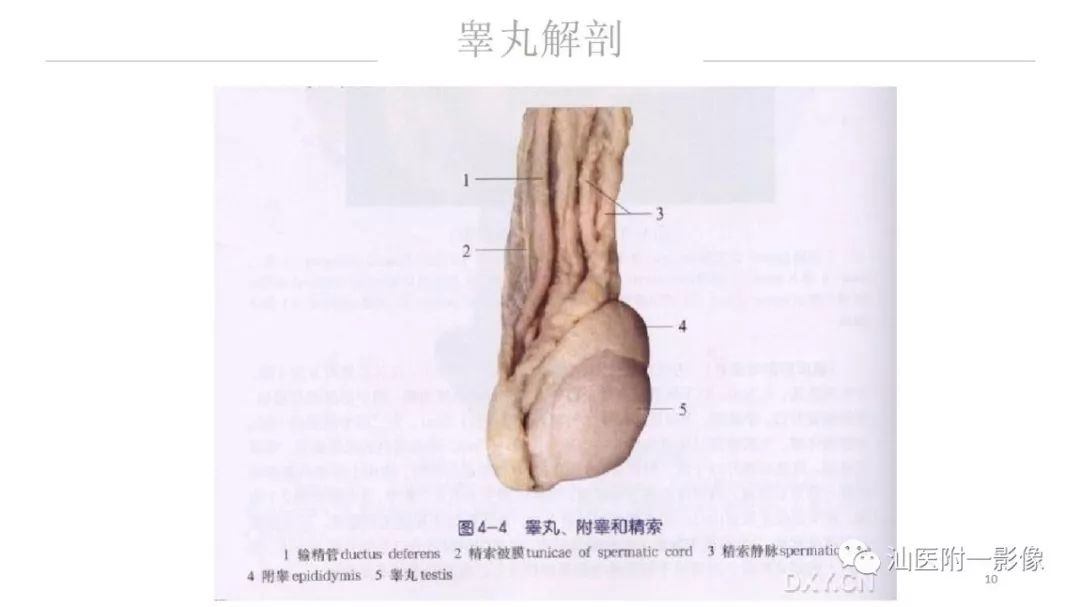影像PPT - 【PPT】睾丸病变知多少-10