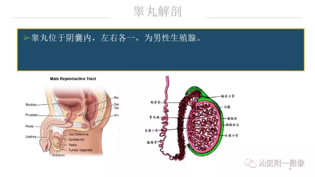 影像PPT - 【PPT】睾丸病变知多少-4
