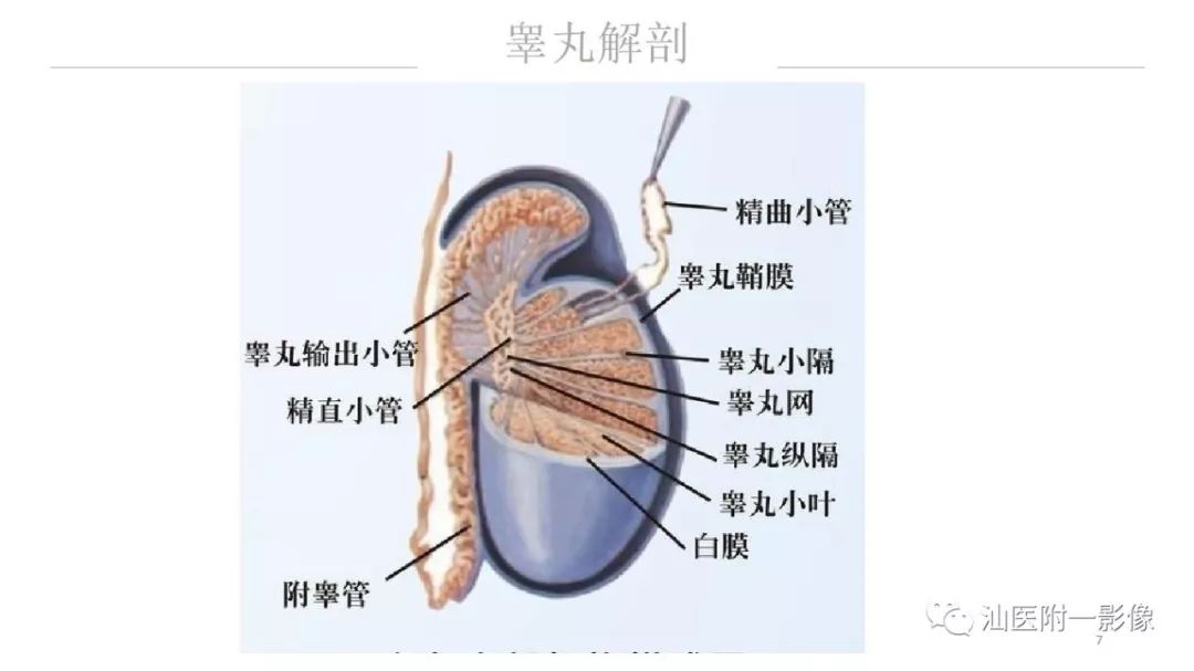 影像PPT - 【PPT】睾丸病变知多少-7