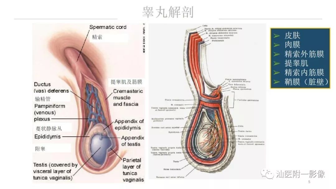 影像PPT - 【PPT】睾丸病变知多少-5