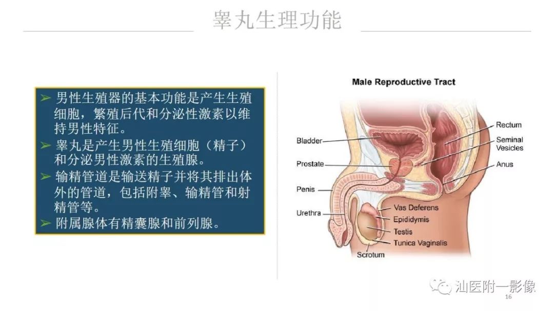 影像PPT - 【PPT】睾丸病变知多少-16