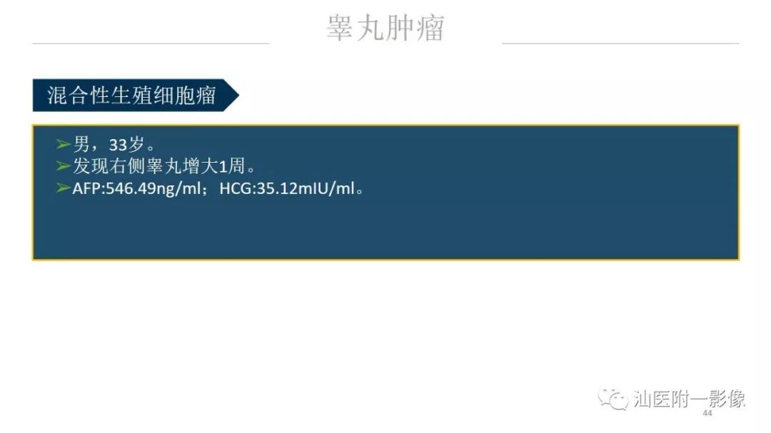影像PPT - 【PPT】睾丸病变知多少-44