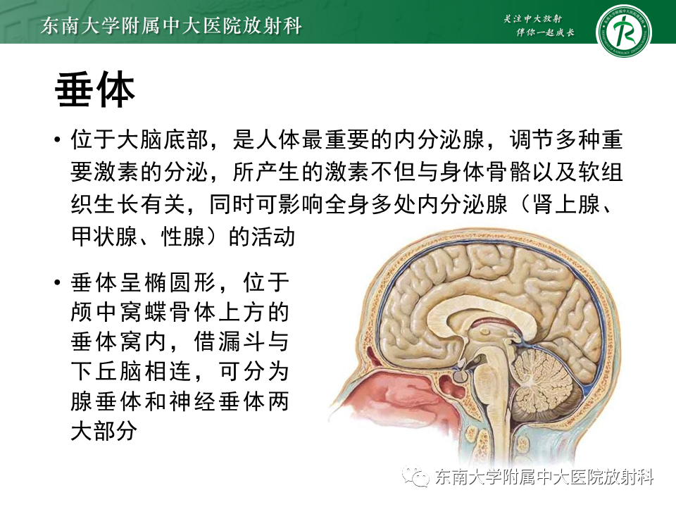 影像PPT - 【PPT】垂体腺瘤影像表现-5