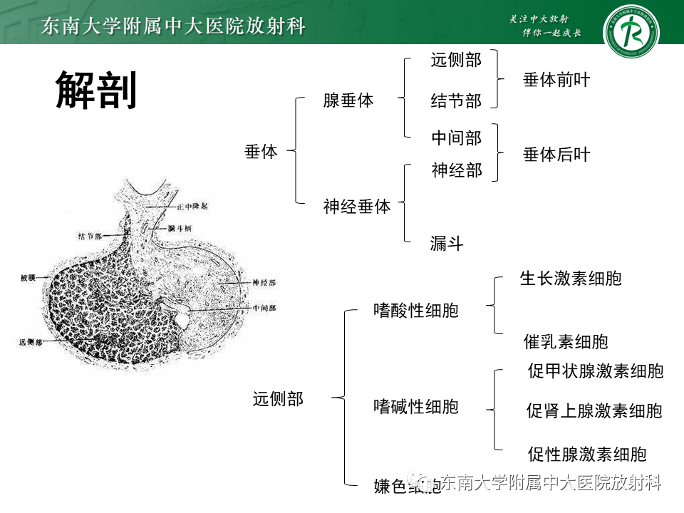 影像PPT - 【PPT】垂体腺瘤影像表现-6
