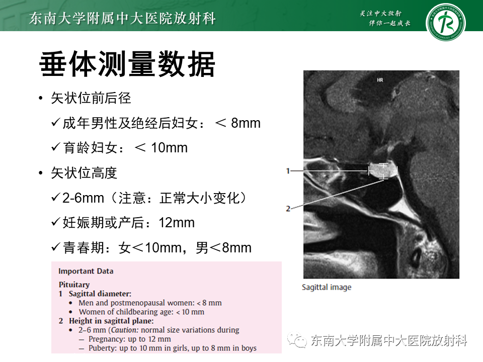 影像PPT - 【PPT】垂体腺瘤影像表现-8
