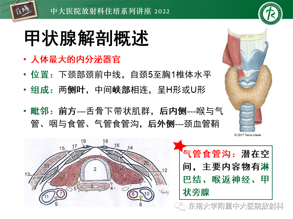 影像PPT - 【PPT】甲状腺肿瘤及肿瘤样病变影像诊断与评估-6