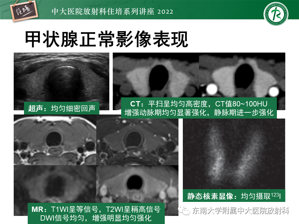 影像PPT - 【PPT】甲状腺肿瘤及肿瘤样病变影像诊断与评估-12