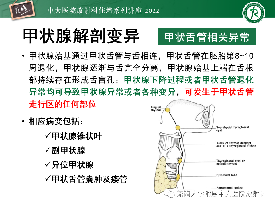 影像PPT - 【PPT】甲状腺肿瘤及肿瘤样病变影像诊断与评估-14